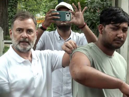 छात्र प्रदर्शन में कथित पेललेट गन के इस्तेमाल पर राहुल गांधी की न्याय की मांग