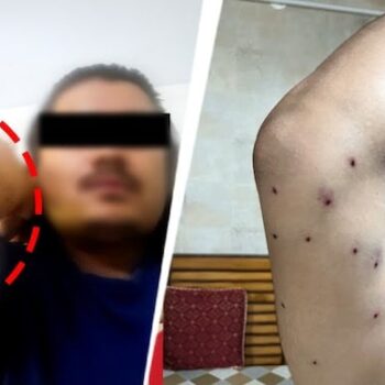संसद मार्च में पैलेट गन के इस्तेमाल का दावा, CRPF ने शुरू की जांच