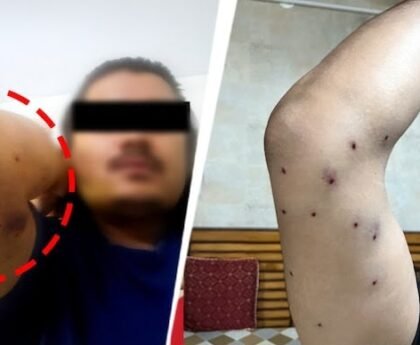 संसद मार्च में पैलेट गन के इस्तेमाल का दावा, CRPF ने शुरू की जांच