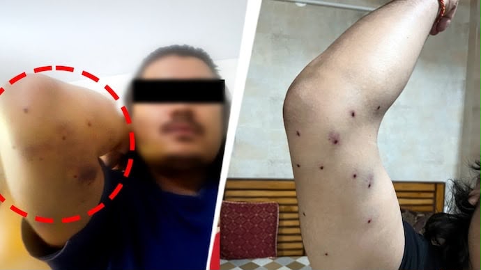 संसद मार्च में पैलेट गन के इस्तेमाल का दावा, CRPF ने शुरू की जांच
